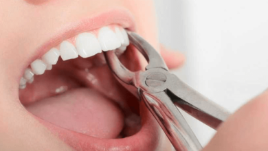 Understanding Tooth Extraction: When It Is Necessary?