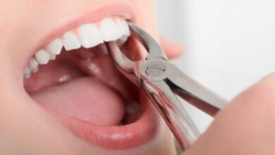 Teeth Extraction