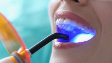 Which is The Most Permanent Teeth Whitening Procedure?