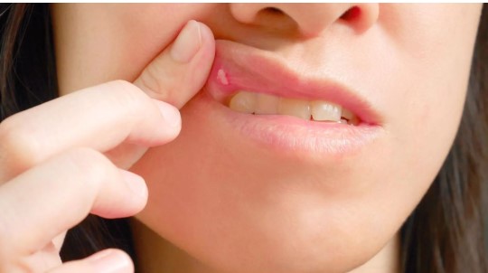 How Bad Oral Hygiene Can Lead to Oral Cancer